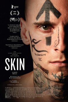 Skin izle